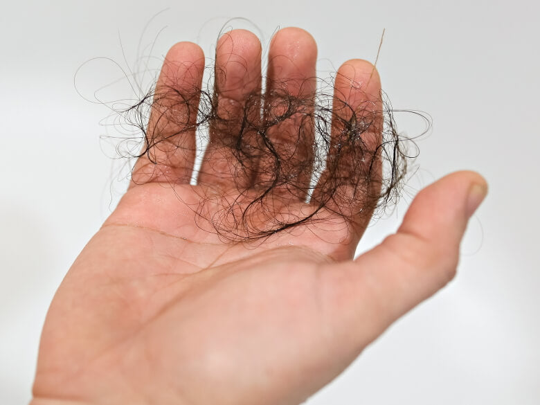 Quels sont les traitements efficaces contre la chute de cheveux ?