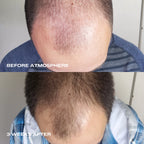 Luna nectar sérum densité pour cuir chevelu- 60ml