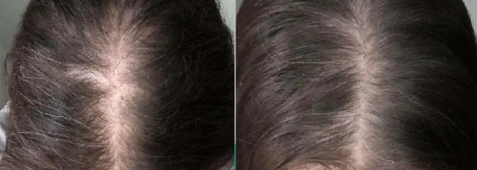 Neoffolics revitalisant stimulant la croissance des cheveux - 250ml