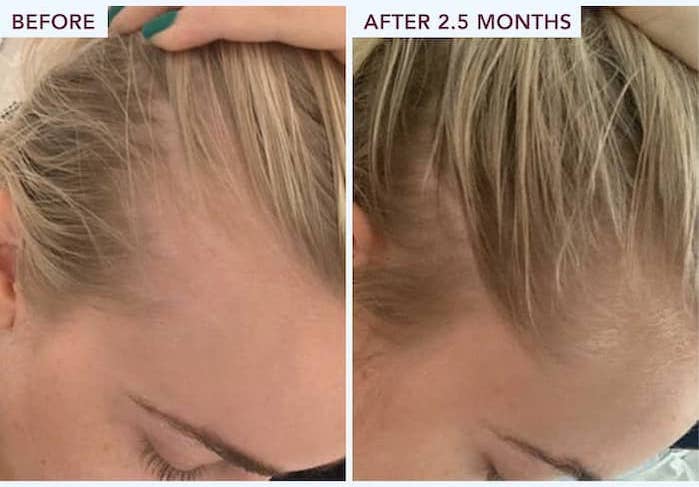 FullyVital sérum de croissance avec exosomes - 55ml