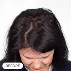 Capillus PLUS S1 casque de luminothérapie à faible niveau de laser (LLLT)